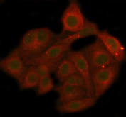 Immunofluorescent staining of FFPE human A549 cells with Phospho-AKT1 Antibody (green) and Beta Actin antibody (red). HIER: steam section in pH6 citrate buffer for 20 min.