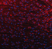Immunofluorescent staining of FFPE rat brain tissue with SLC39A10 antibody (red) and DAPI nuclear stain (blue). HIER: steam section in pH8 EDTA buffer for 20 min.