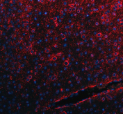 Immunofluorescent staining of FFPE mouse brain tissue with SLC39A10 antibody (red) and DAPI nuclear stain (blue). HIER: steam section in pH8 EDTA buffer for 20 min.