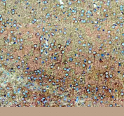 IHC staining of FFPE mouse brain tissue with SLC39A10 antibody, HRP-secondary and DAB substrate. HIER: boil tissue sections in pH8 EDTA for 20 min and allow to cool before testing.