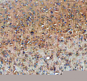 IHC staining of FFPE rat brain tissue with SLC39A10 antibody, HRP-secondary and DAB substrate. HIER: boil tissue sections in pH8 EDTA for 20 min and allow to cool before testing.