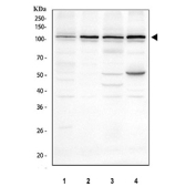 Western blot testing of human 1) HeLa, 2) Caco-2, 3) A549 and 4) SiHa cell lysate with SLC39A10 antibody. Predicted molecular weight ~94 kDa.