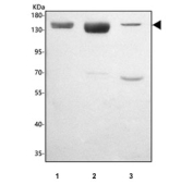 Western blot testing of 1) rat liver, 2) mouse liver and 3) mouse lung tissue lysate with XDH antibody. Predicted molecular weight ~146 kDa.