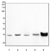 Western blot testing of 1) human MCF7, 2) human RT4, 3) human HepG2, 4) human placenta and 5) mouse liver tissue lysate with HSD17B2 antibody. Predicted molecular weight ~43 kDa.