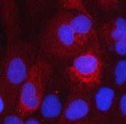 Immunofluorescent staining of FFPE human A431 cells with HSD17B2 antibody (red) and DAPI nuclear stain (blue). HIER: steam section in pH6 citrate buffer for 20 min.