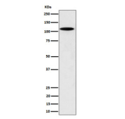 Western blot testing of rat PC-12 cell lysate with N4BP1 antibody. Predicted molecular weight ~100 kDa.