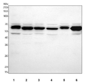Western blot testing of 1) human K562, 2) human SiHa, 3) human Jurkat, 4) human MCF7, 5) rat liver and 6) RAW264.7 cell lysate with SLC25A25 antibody. Predicted molecular weight: 53-57 kDa, ~41 kDa (multiple isoforms).