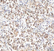 IHC staining of FFPE human testicular seminoma tissue with IPO9 antibody. HIER: boil tissue sections in pH8 EDTA for 20 min and allow to cool before testing.
