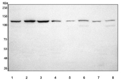 Western blot testing of 1) human SiHa, 2) human HeLa, 3) human Caco-2, 4) human RT4, 5) rat liver, 6) rat brain, 7) mouse liver and 8) mouse brain tissue lysate with IPO9 antibody. Predicted molecular weight ~116 kDa, but it is often observed at higher molecular weights due to protein complexing.