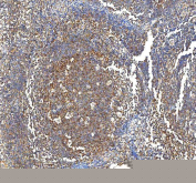 IHC staining of FFPE human tonsil tissue with PFKP antibody. HIER: boil tissue sections in pH8 EDTA for 20 min and allow to cool before testing.