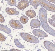 IHC staining of FFPE mouse testis tissue with IRS4 antibody. HIER: boil tissue sections in pH8 EDTA for 20 min and allow to cool before testing.