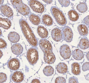 IHC staining of FFPE rat testis tissue with IRS4 antibody. HIER: boil tissue sections in pH8 EDTA for 20 min and allow to cool before testing.
