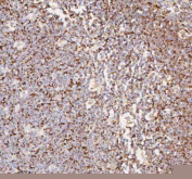 IHC staining of FFPE human tonsil tissue with IRS4 antibody. HIER: boil tissue sections in pH8 EDTA for 20 min and allow to cool before testing.