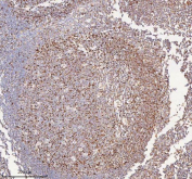 IHC staining of FFPE human tonsil tissue with IRS4 antibody. HIER: boil tissue sections in pH8 EDTA for 20 min and allow to cool before testing.
