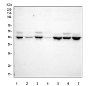 Western blot testing of 1) human 293T, 2) human HeLa, 3) human Jurkat, 4) human A431, 5) rat brain, 6) rat C6 and 7) mouse brain tissue lysate with JNK1 antibody. Predicted molecular weight: 44-48 kDa (multiple isoforms).