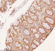 IHC staining of FFPE human colon tissue with SLK antibody. HIER: boil tissue sections in pH8 EDTA for 20 min and allow to cool before testing.