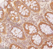 IHC staining of FFPE human colon tissue with SLK antibody. HIER: boil tissue sections in pH8 EDTA for 20 min and allow to cool before testing.