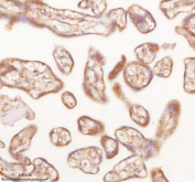 IHC staining of FFPE human placental tissue with SLK antibody. HIER: boil tissue sections in pH8 EDTA for 20 min and allow to cool before testing.