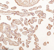 IHC staining of FFPE human placental tissue with SLK antibody. HIER: boil tissue sections in pH8 EDTA for 20 min and allow to cool before testing.