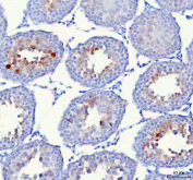IHC staining of FFPE rat testis tissue with HSPA1L antibody. HIER: boil tissue sections in pH8 EDTA for 20 min and allow to cool before testing.