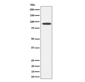 Western blot testing of human SH-SY5Y cell lysate with GlyT2 antibody. Predicted molecular weight ~87 kDa.