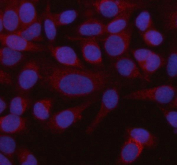 Immunofluorescent staining of FFPE human HeLa cells with HADHB antibody (red) and DAPI nuclear stain (blue). HIER: steam section in pH6 citrate buffer for 20 min.