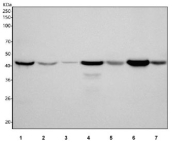 Western blot testing of 1) human HepG2, 2) human MCF7, 3) human Jurkat, 4) rat heart, 5) rat skeletal muscle, 6) mouse heart and mouse skeletal muscle tissue lysate with HADHB antibody. Predicted molecular weight ~51 kDa, ~49 kDa.