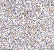 IHC staining of FFPE human testicular seminoma tissue with HADHB antibody. HIER: boil tissue sections in pH8 EDTA for 20 min and allow to cool before testing.