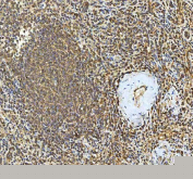 IHC staining of FFPE human spleen tissue with SMIM8 antibody. HIER: boil tissue sections in pH8 EDTA for 20 min and allow to cool before testing.
