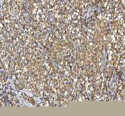 IHC staining of FFPE human testicular seminoma tissue with SMIM8 antibody. HIER: boil tissue sections in pH8 EDTA for 20 min and allow to cool before testing.