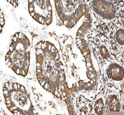 IHC staining of FFPE human colon tissue with SMIM8 antibody. HIER: boil tissue sections in pH8 EDTA for 20 min and allow to cool before testing.