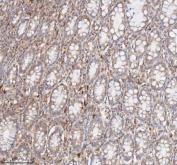 IHC staining of FFPE human colon tissue with CD127 antibody. HIER: boil tissue sections in pH8 EDTA for 20 min and allow to cool before testing.