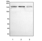 Western blot testing of human 1) MOLT4, 2) K562 and 3) Jurkat cell lysate with CD127 antibody. Predicted molecular weight: 52-90 kDa depending on level of glycosylation; the dimer form is observed at ~150 kDa.