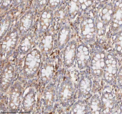 IHC staining of FFPE human colon tissue with CD127 antibody. HIER: boil tissue sections in pH8 EDTA for 20 min and allow to cool before testing.