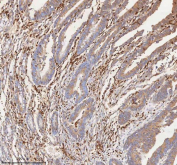 IHC staining of FFPE human colon tissue with CD127 antibody. HIER: boil tissue sections in pH8 EDTA for 20 min and allow to cool before testing.