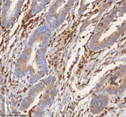 IHC staining of FFPE human colon tissue with CD127 antibody. HIER: boil tissue sections in pH8 EDTA for 20 min and allow to cool before testing.