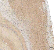 IHC staining of FFPE rat brain tissue with Hcn2 antibody. HIER: boil tissue sections in pH8 EDTA for 20 min and allow to cool before testing.