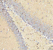 IHC staining of FFPE rat brain tissue with Hcn2 antibody. HIER: boil tissue sections in pH8 EDTA for 20 min and allow to cool before testing.