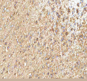 IHC staining of FFPE rat brain tissue with Hcn2 antibody. HIER: boil tissue sections in pH8 EDTA for 20 min and allow to cool before testing.