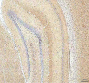 IHC staining of FFPE rat brain tissue with Hcn2 antibody. HIER: boil tissue sections in pH8 EDTA for 20 min and allow to cool before testing.