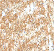 IHC staining of FFPE rat cardiac tissue with Hcn2 antibody. HIER: boil tissue sections in pH8 EDTA for 20 min and allow to cool before testing.
