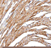 IHC staining of FFPE mouse cardiac tissue with Hcn2 antibody. HIER: boil tissue sections in pH8 EDTA for 20 min and allow to cool before testing.