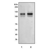 Western blot testing of 1) rat brain and 2) mouse brain tissue lysate with Hcn2 antibody. Predicted molecular weight: 97-105 kDa (unmodified), 115-130 kDa (glycosylated).