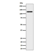 Western blot testing of human HeLa cell lysate with SPINK5 antibody. Predicted molecular weight ~121 kDa.