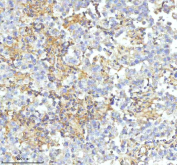IHC staining of FFPE human testicular seminoma tissue with HDHD2 antibody. HIER: boil tissue sections in pH8 EDTA for 20 min and allow to cool before testing.