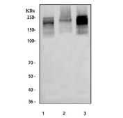Western blot testing of human 1) Jurkat, 2) SH-SY5Y and 3) HEL cell lysate with TNRC6C antibody. Predicted molecular weight ~176 kDa, commonly observed at 176-210 kDa.