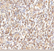 IHC staining of FFPE human testicular seminoma tissue with MANSC4 antibody. HIER: boil tissue sections in pH8 EDTA for 20 min and allow to cool before testing.