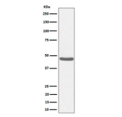 Western blot testing of human HeLa cell lysate with BCKDK antibody. Predicted molecular weight ~46 kDa.