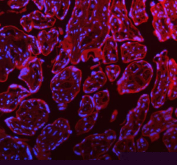Immunofluorescent staining of FFPE human placental tissue with STIM1 antibody (red) and DAPI nuclear stain (blue). HIER: steam section in pH8 EDTA buffer for 20 min.