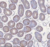 IHC staining of FFPE rat testis tissue with STIM1 antibody. HIER: boil tissue sections in pH8 EDTA for 20 min and allow to cool before testing.